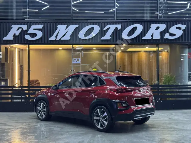 F5 MOTORS'TAN 2020 MODEL HYUNDAİ KONA 1.6 DİZEL ELİTE SMART