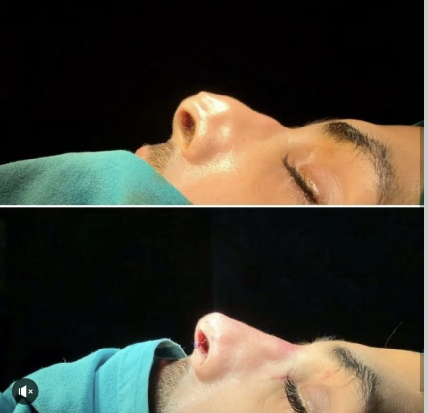 الدكتور الجراح اولكر مناف باشي 