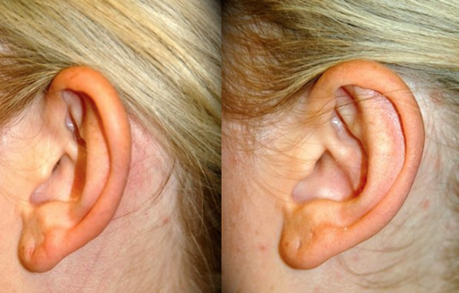 الجراح الدكتور اولكر مناف باشي