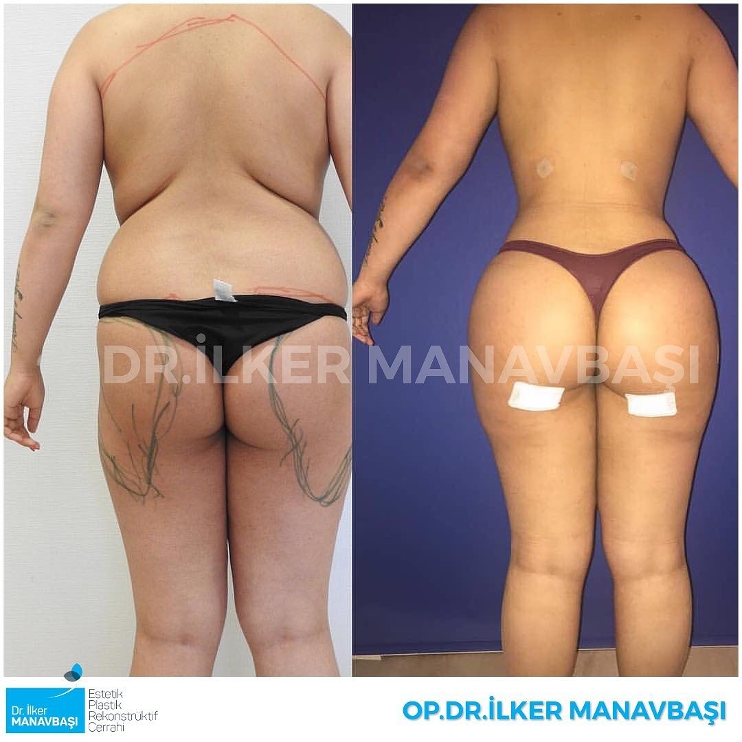 الجراح الدكتور اولكر مناف باشي