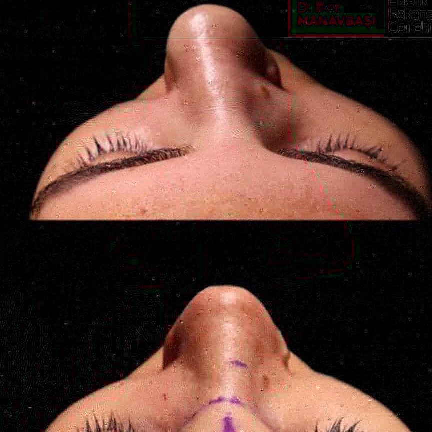 Cerrah Doktor Ilker Manavbaşı